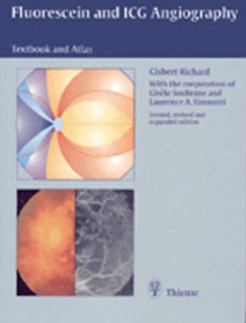 Fluorescein and ICG Angiography - Gisbert Richard