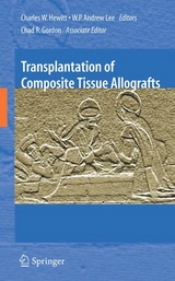 Transplantation of Composite Tissue Allografts - 
