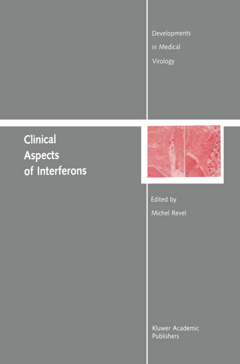 Clinical Aspects of Interferons - 