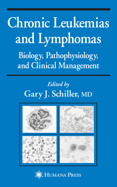 Chronic Leukemias and Lymphomas - 