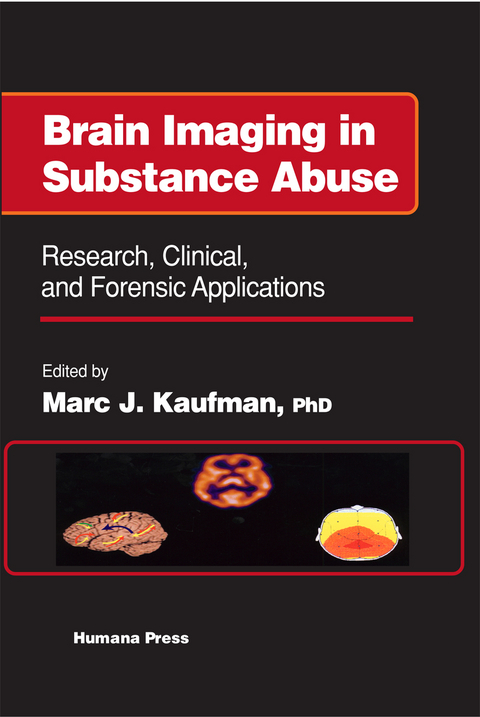 Brain Imaging in Substance Abuse - 