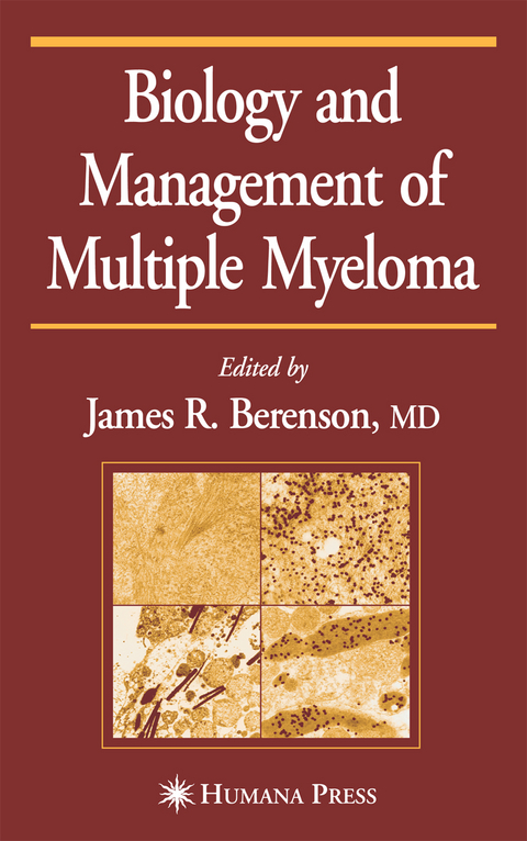 Biology and Management of Multiple Myeloma - 