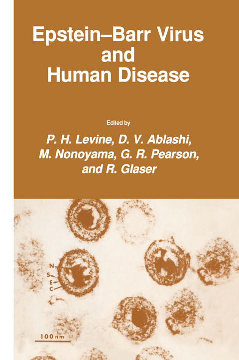 Epstein-Barr Virus and Human Disease - P. H. Levine, D. V. Ablashi, M. Nonoyama, G. R. Pearson, R. Glaser