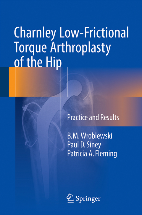 Charnley Low-Frictional Torque Arthroplasty of the Hip - B.M. Wroblewski, Paul D. Siney, Patricia A. Fleming