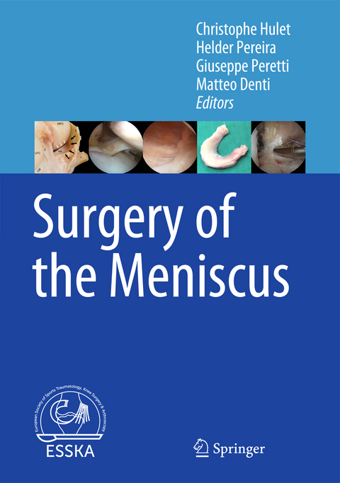 Surgery of the Meniscus - 