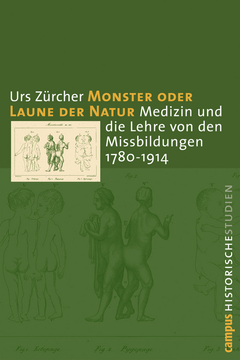 Monster oder Laune der Natur - Urs Zürcher