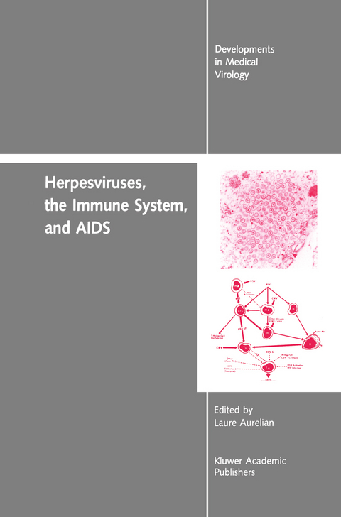 Herpesviruses, the Immune System, and AIDS - Yechiel Becker