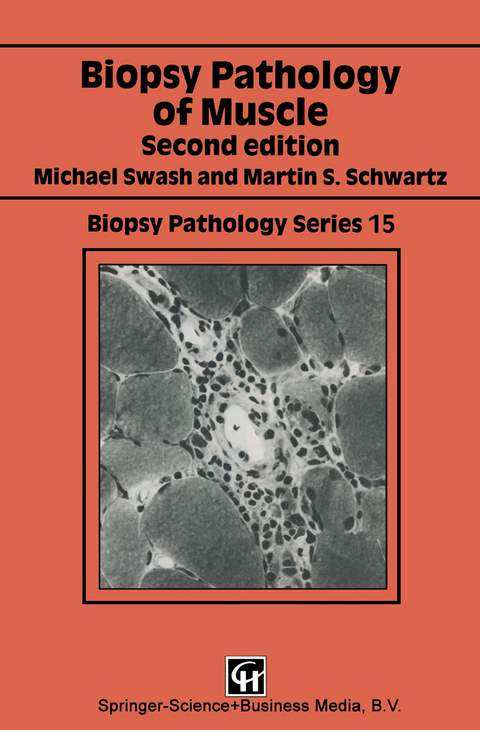 Biopsy Pathology of Muscle - Michael Swash, Martin S. Schwartz