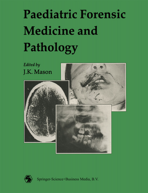 Paediatric Forensic Medicine and Pathology - J. K. Mason