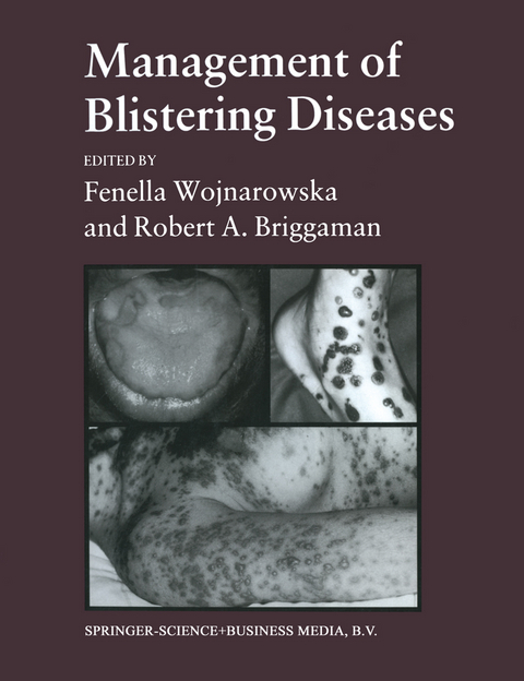 Management of Blistering Diseases - Robert A. Briggaman Fenella Wojnarowska