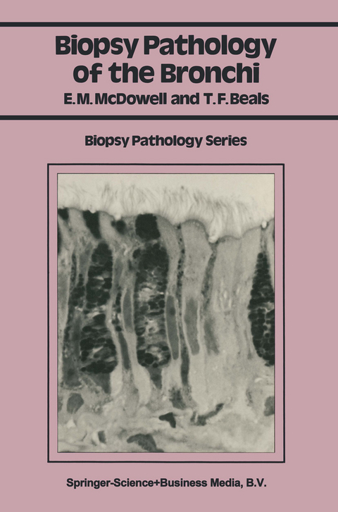 Biopsy Pathology of the Bronchi - Elizabeth M. McDowell, Theodore F. Beals