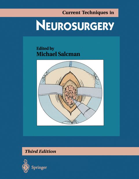 Current Techniques in Neurosurgery - 