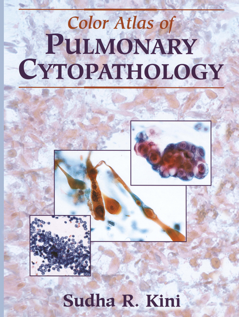 Color Atlas of Pulmonary Cytopathology - Sudha R. Kini