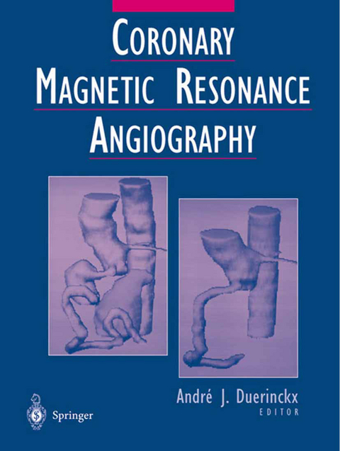 Coronary Magnetic Resonance Angiography - 