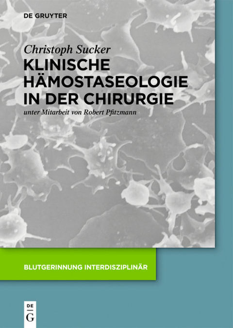 Klinische Hämostaseologie in der Chirurgie - Christoph Sucker