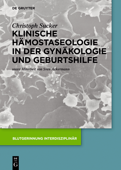 Klinische Hämostaseologie in der Gynäkologie und Geburtshilfe - Christoph Sucker