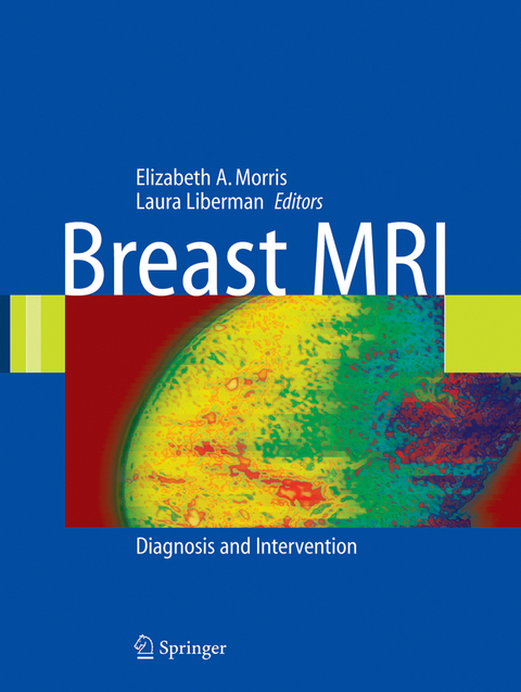 Breast MRI - 