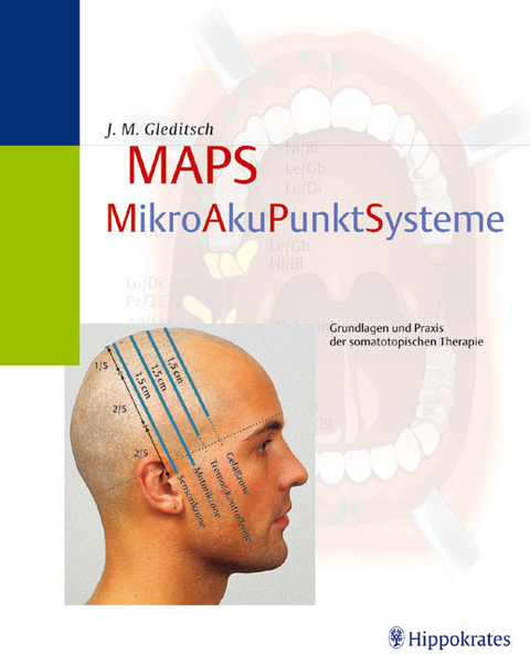 MAPS - MikroAkuPunktSysteme - Jochen M Gleditsch, Hans P Ogal