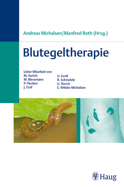 Blutegeltherapie - 