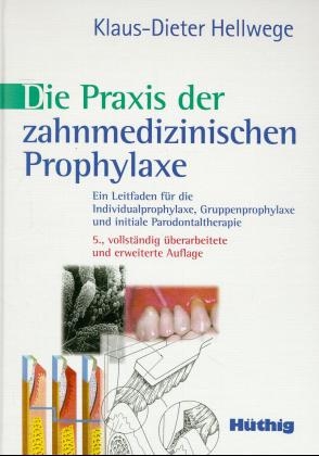 Die Praxis der zahnmedizinischen Prophylaxe - Klaus D Hellwege