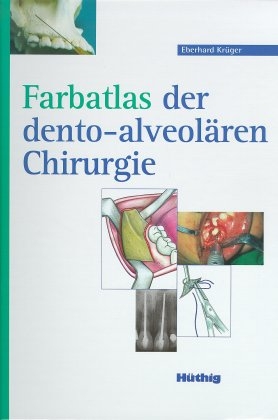 Farbatlas der dento-alveolären Chirurgie - Eberhard Krüger
