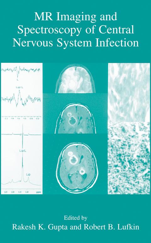 MR Imaging and Spectroscopy of Central Nervous System Infection - 