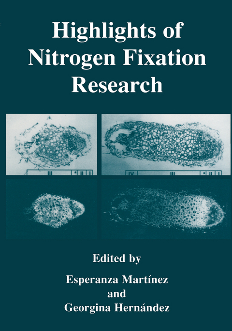 Highlights of Nitrogen Fixation Research - 