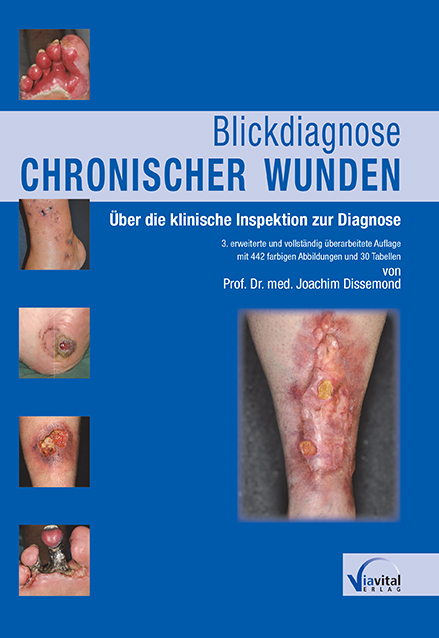 Blickdiagnose chronischer Wunden - Joachim Dissemond
