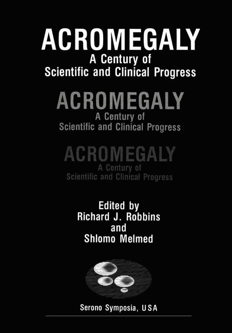 Acromegaly - Richard J. Robbins