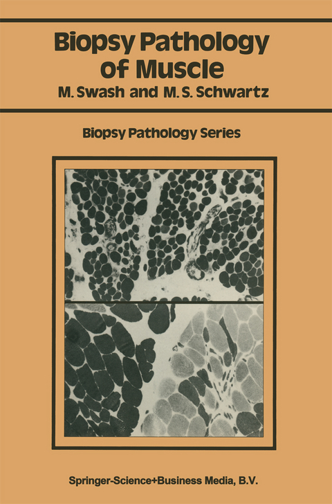 Biopsy pathology of muscle - Michael Swash, Martin S. Schwartz