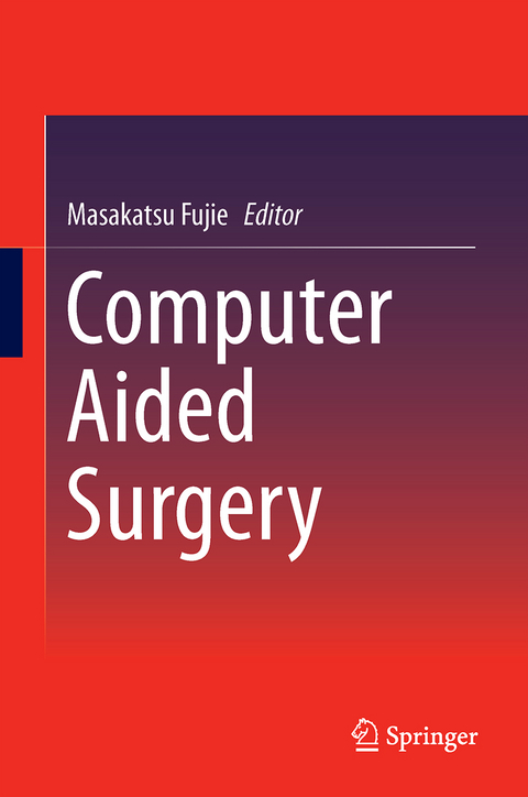 Computer Aided Surgery - 