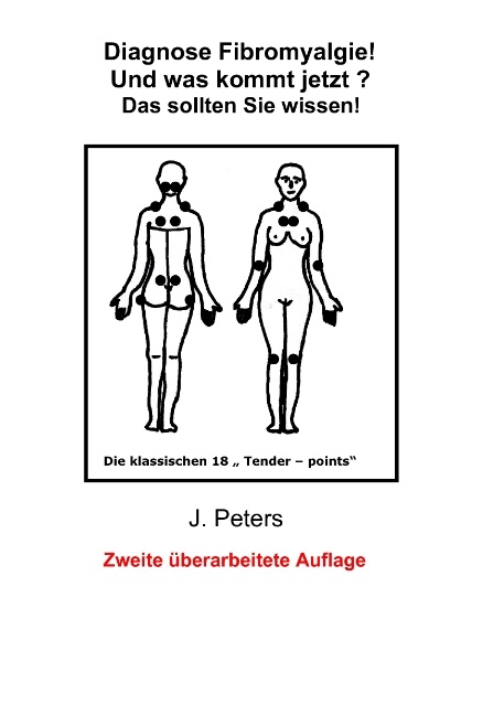 Diagnose Fibromyalgie! Und was kommt jetzt? - Joachim Peters