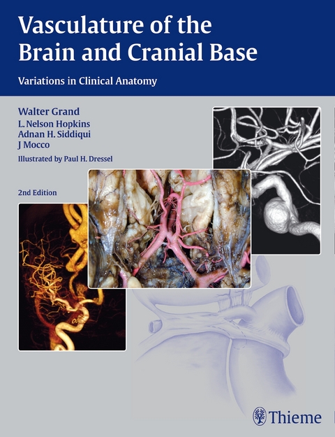 Vasculature of the Brain and Cranial Base - Walter Grand, L. Nelson Hopkins, Adnan H. Siddiqui, J Mocco