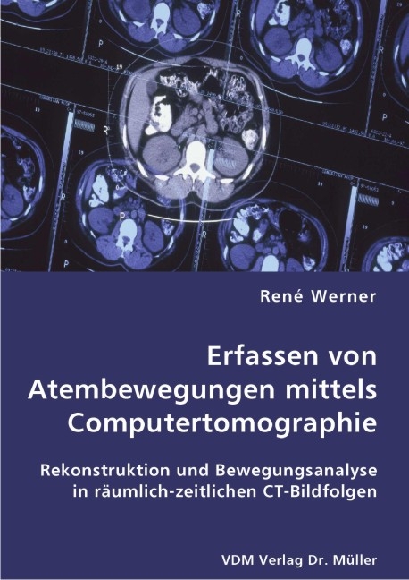 Erfassen von Atembewegungen mittels Computertomographie - René Werner