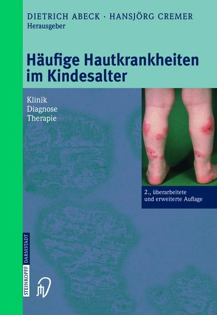 Häufige Hautkrankheiten im Kindesalter - 