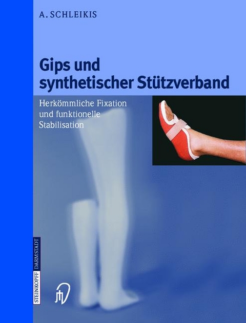 Gips und synthetischer Stützverband - Adolf Schleikis