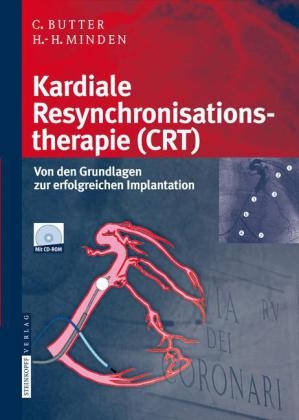 Kardiale Resynchronisationstherapie (CRT) - Christian Butter, Hans-Heinrich Minden