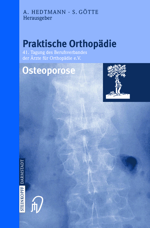 Osteoporose - 