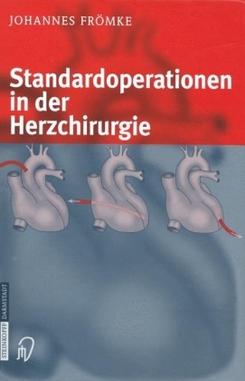 Standardoperationen in der Herzchirurgie - Johannes Frömke