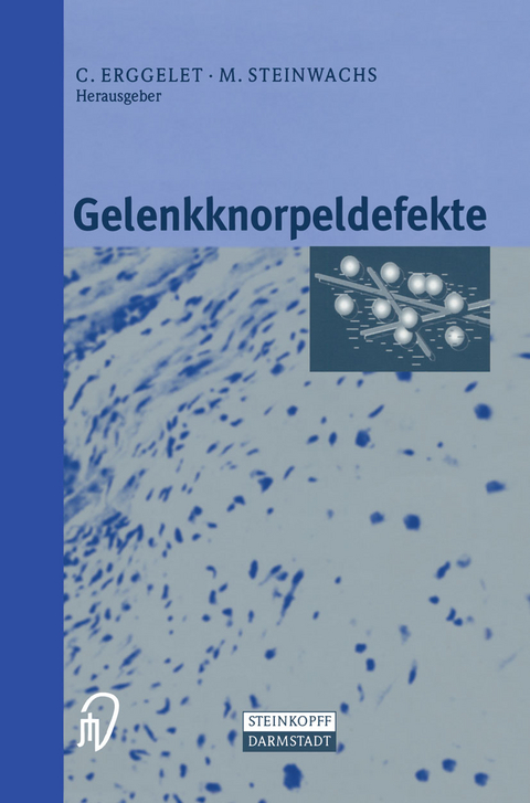 Gelenkknorpeldefekte - 