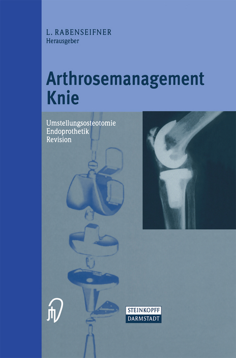 Arthrosemanagement Knie - 