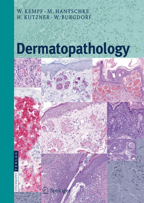 Dermatopathology - Werner Kempf, Markus Hantschke, Heinz Kutzner, Walter H.C. Burgdorf