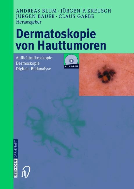 Dermatoskopie von Hauttumoren - 