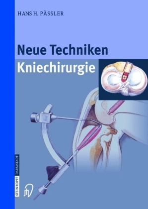 Neue Techniken Kniechirurgie - H.H. Pässler