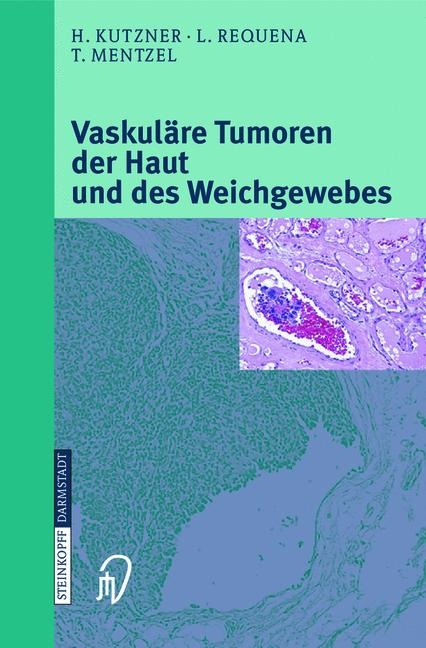 Vaskuläre Tumoren der Haut und des Weichgewebes - H. Kutzner, L. Requena, T. Mentzel