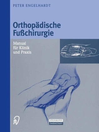 Orthopädische Fußchirurgie - Peter Engelhardt