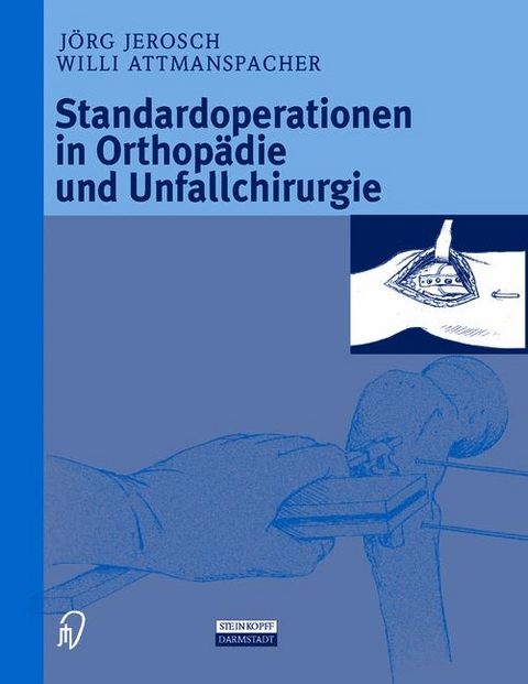Standardoperationen in Orthopädie und Unfallchirurgie - J. Jerosch, W. Attmanspacher