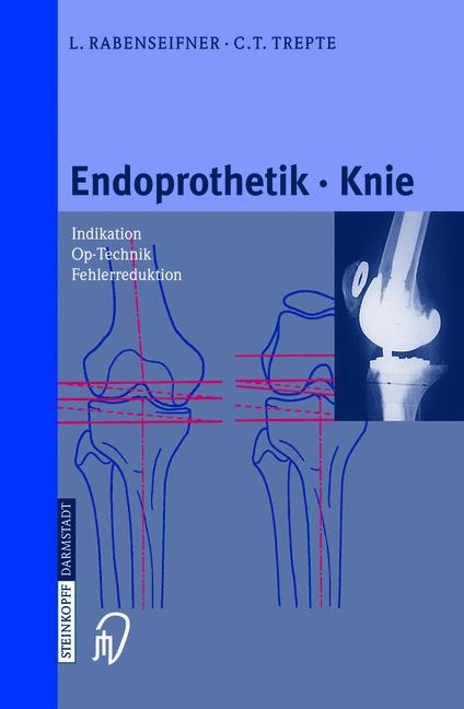 Endoprothetik Knie - L. Rabenseifner, C. Trepte