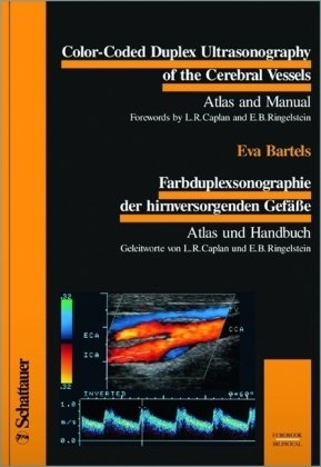 Color-Coded Duplex Ultrasonography of the Cerebral Vessels. Farbduplexsonographie der hirnversorgenden Gefässe - Eva Bartels