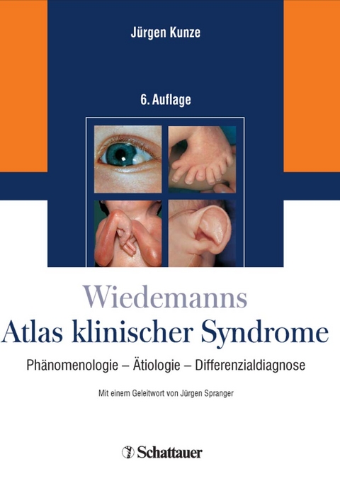 Wiedemanns Atlas klinischer Syndrome - Jürgen Kunze